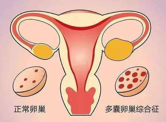 3.8婦女節過後！山東中仁中醫體質測試係統教您預防卵巢疾病