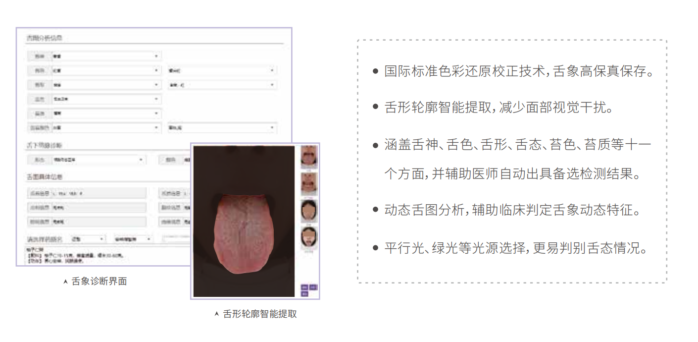 舌診儀(yi) （中醫舌象信息采集管理係統）MT-SX-02舌象分析特點.png