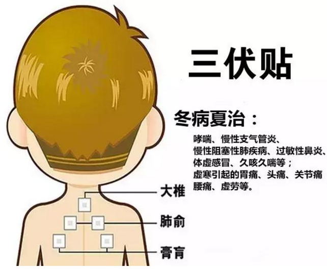 夏至過後，中醫體質辨識係統喊您來貼三伏貼啦！
