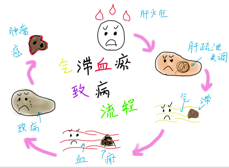 陝西西安中醫體質辨識係統設備介紹“氣滯血瘀”代表啥意思？
